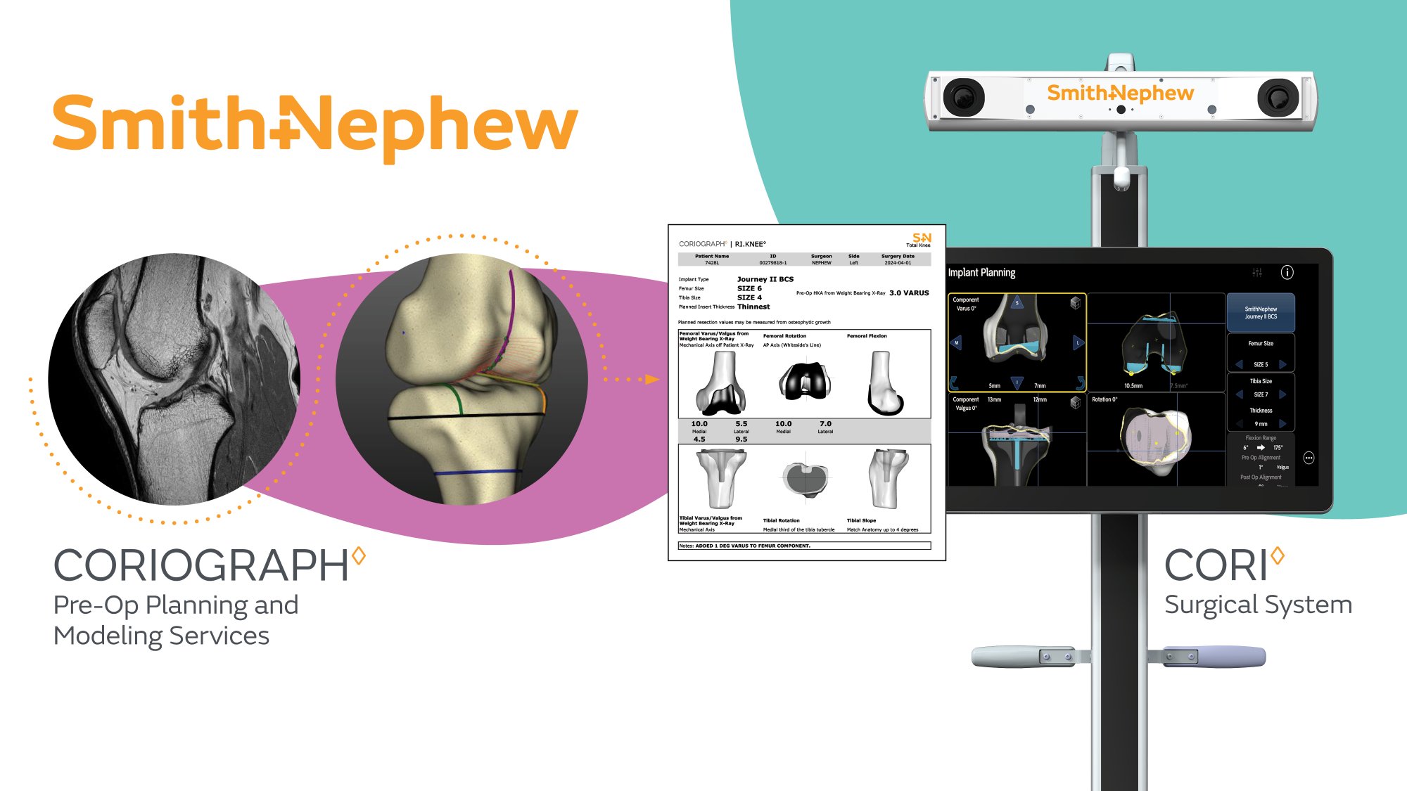 CORIOGRAPH - Planeación preoperatoria robótica